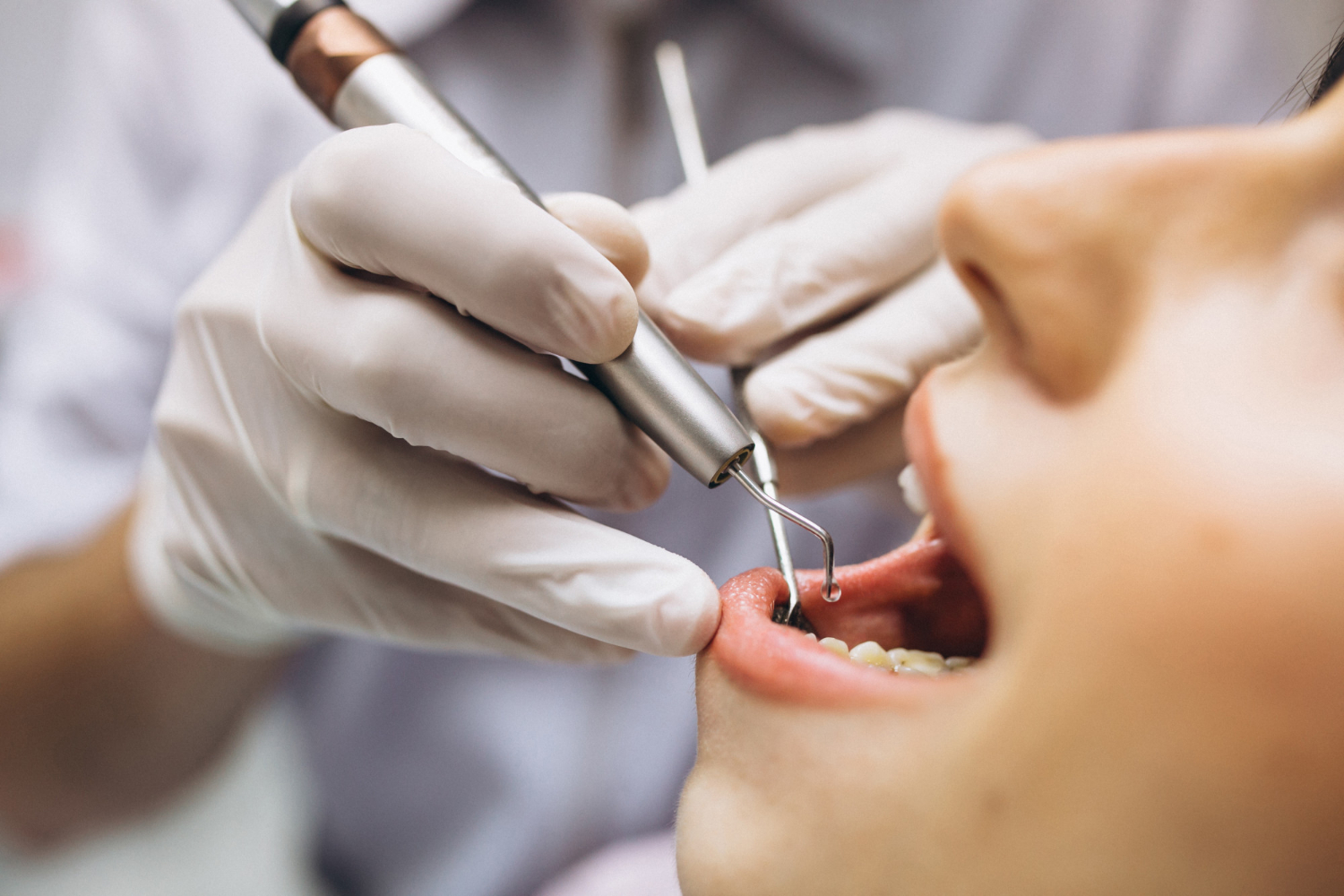 Saúde bucal: na imagem, um par de mãos com luvas examina a boca de uma mulher com instrumentos odontológicos.
